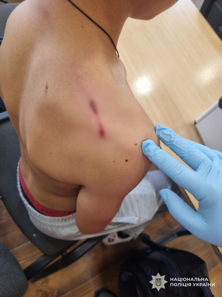 На Закарпатті учень вистрілив у однокласника: поліція працює на місці події